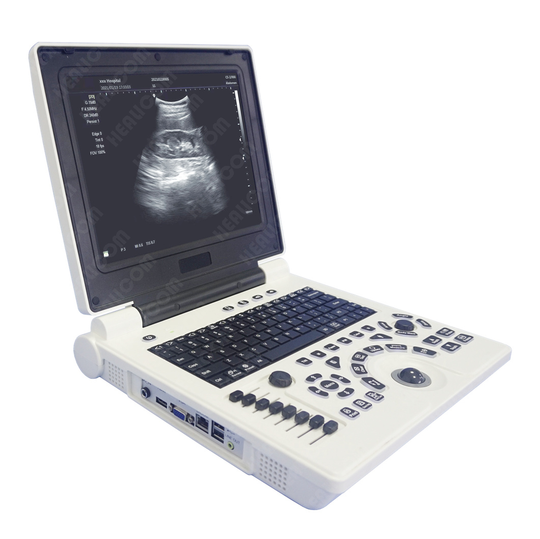 HBW-6P Full Digital Laptop B/W Ultrasound Scanner