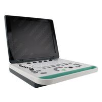 HBW-9 PC Based Full Digital Laptop B/W Ultrasound Scanner